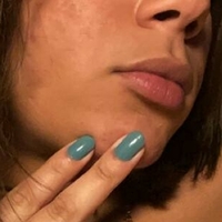 Melolo Nude